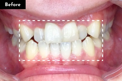 Case 02 Before
