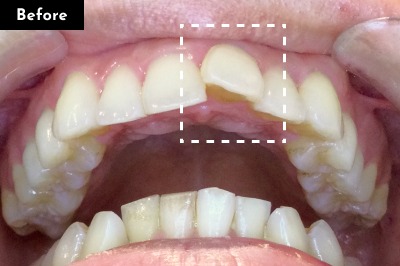 Case 03 Before