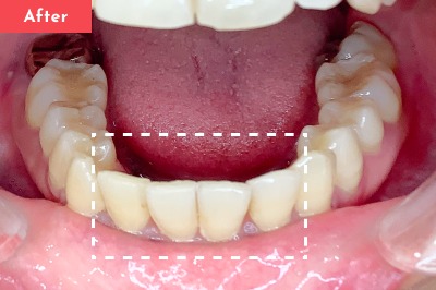Case 04 After