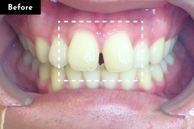 Case 05 Before